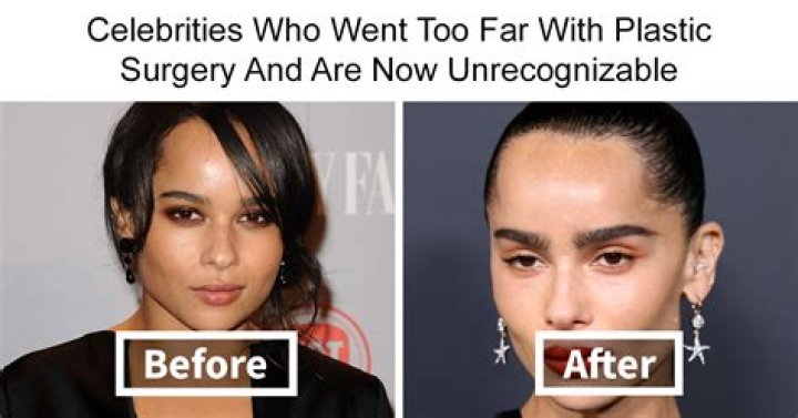 
Did Teresa Ruiz Ever Had A Plastic Surgery Done? Fans Wonder If Her Body Style Is Natural Or Transformed 