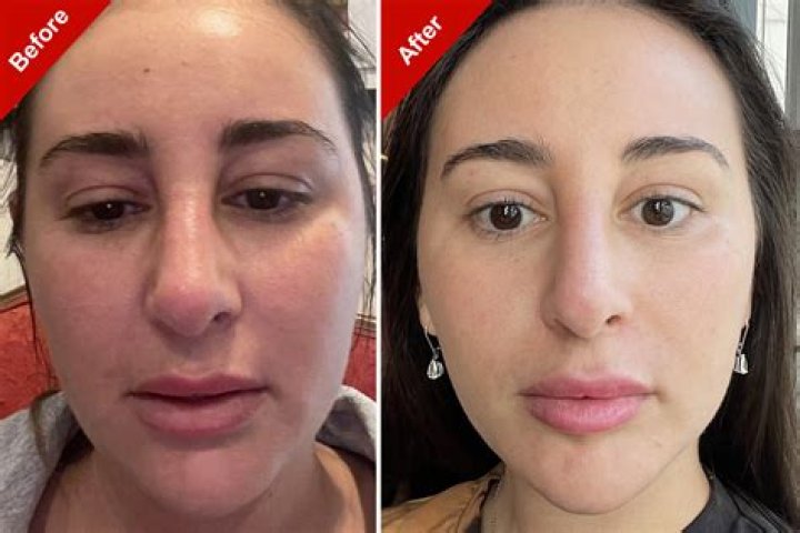 Grace Kinstler Health And Weight Loss: Did She Have Surgery For Her Hips?