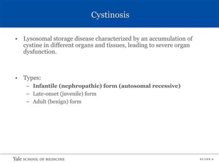 What Is Willow Pill Illness? Cystinosis Disease and Health Update 2022